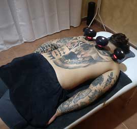 Tratamiento con ventosas para rehabilitacion